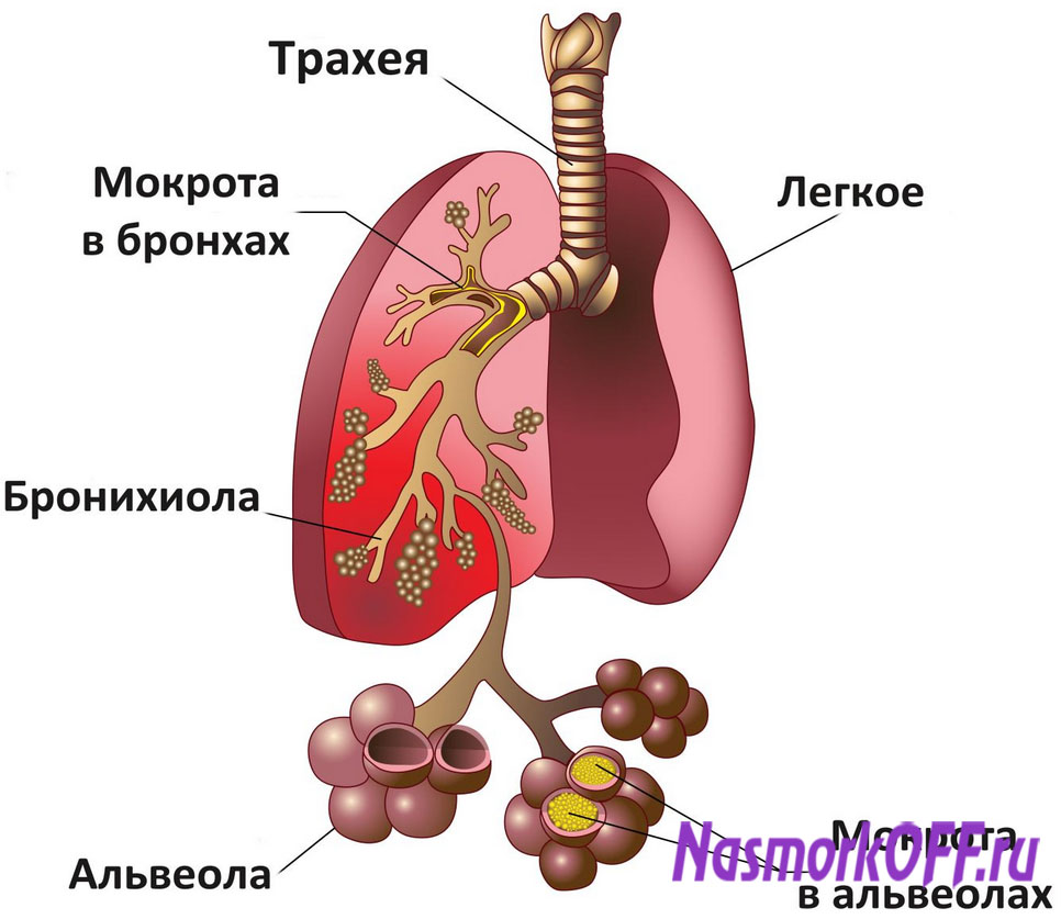 Причины кашля