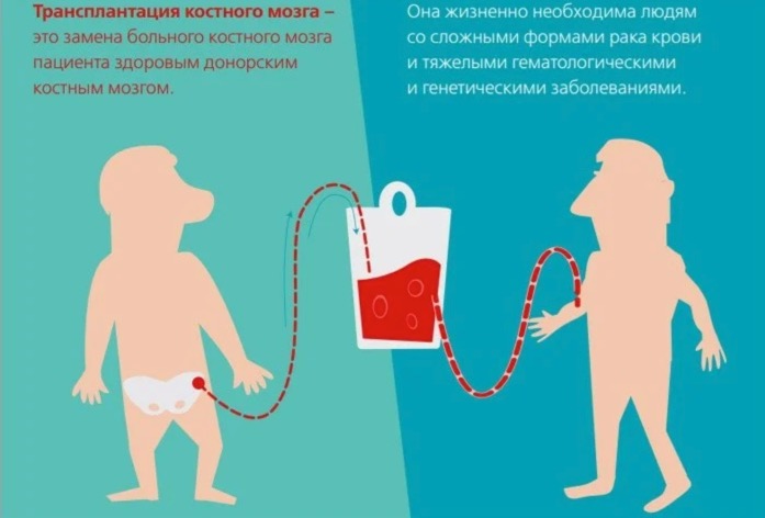 3 как сдают костный мозг