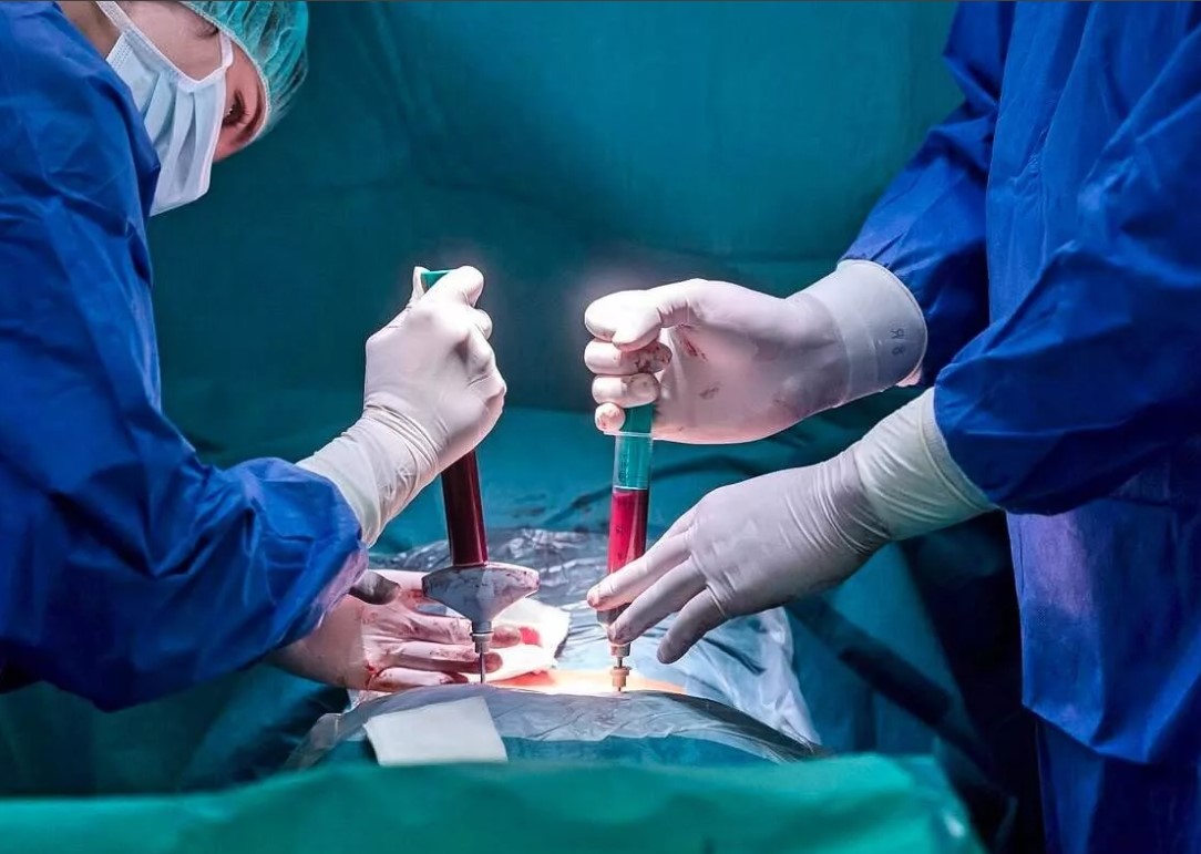 7 трансплантация костного мозга