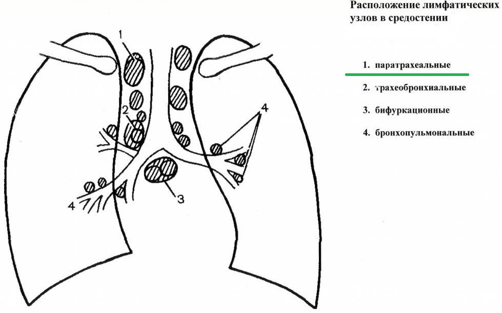 Расположение основных групп лимфоузлов в средостении