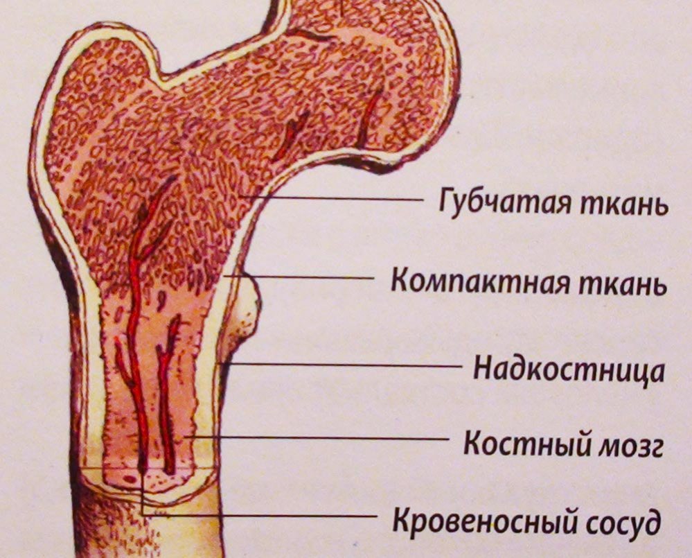 Что такое аплазия костного мозга