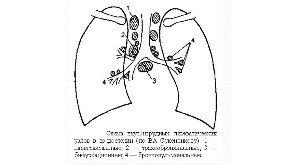 Внутригрудные лимфатические узлы