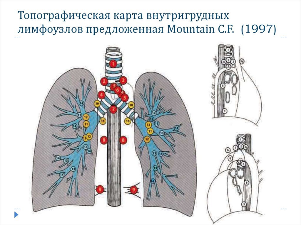 Внутригрудные лимфоузлы
