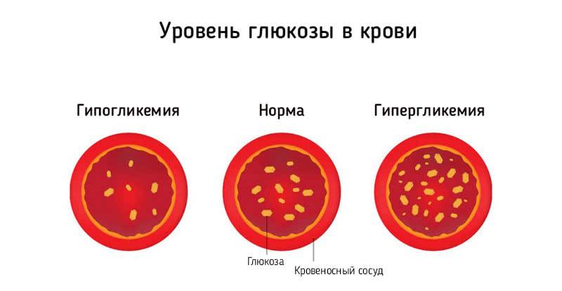 Уровень глюкозы в крови