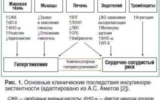 Инсулинорезистентность и сахарный диабет. Все в одной статье
