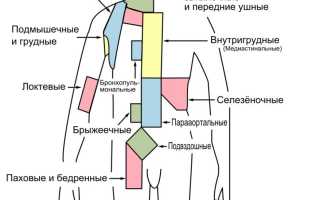 Лимфаденопатия: классификация, признаки и лечение