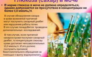 Сахар в моче (глюкозурия)