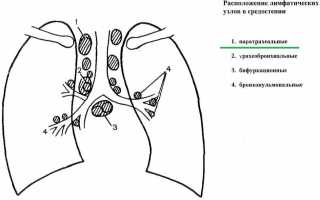 Паратрахеальные лимфоузлы: где находятся и почему воспаляются