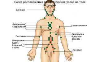 Лимфоузлы в паху у мужчин: особенности расположения, причины воспаления