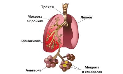 lechenieantibiotikamipnevmoniivospalenie_67376B08
