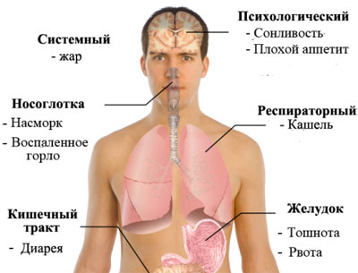 Симптомы свиного гриппа Симптомы свиного гриппа